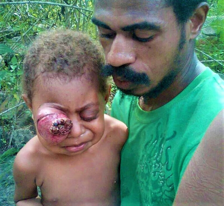 Help Peter Elijah