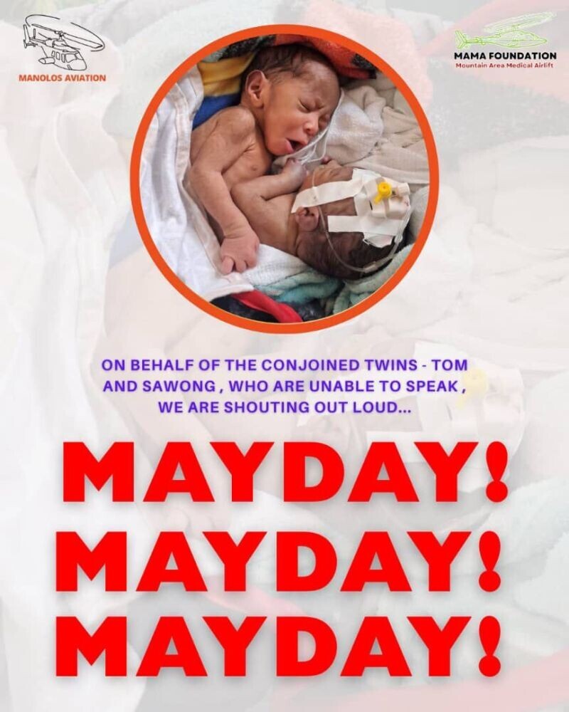 A Call for Help: Conjoined Twins Born Near PNG’s First Missionary Site Need Urgent Medical Assistance Abroad